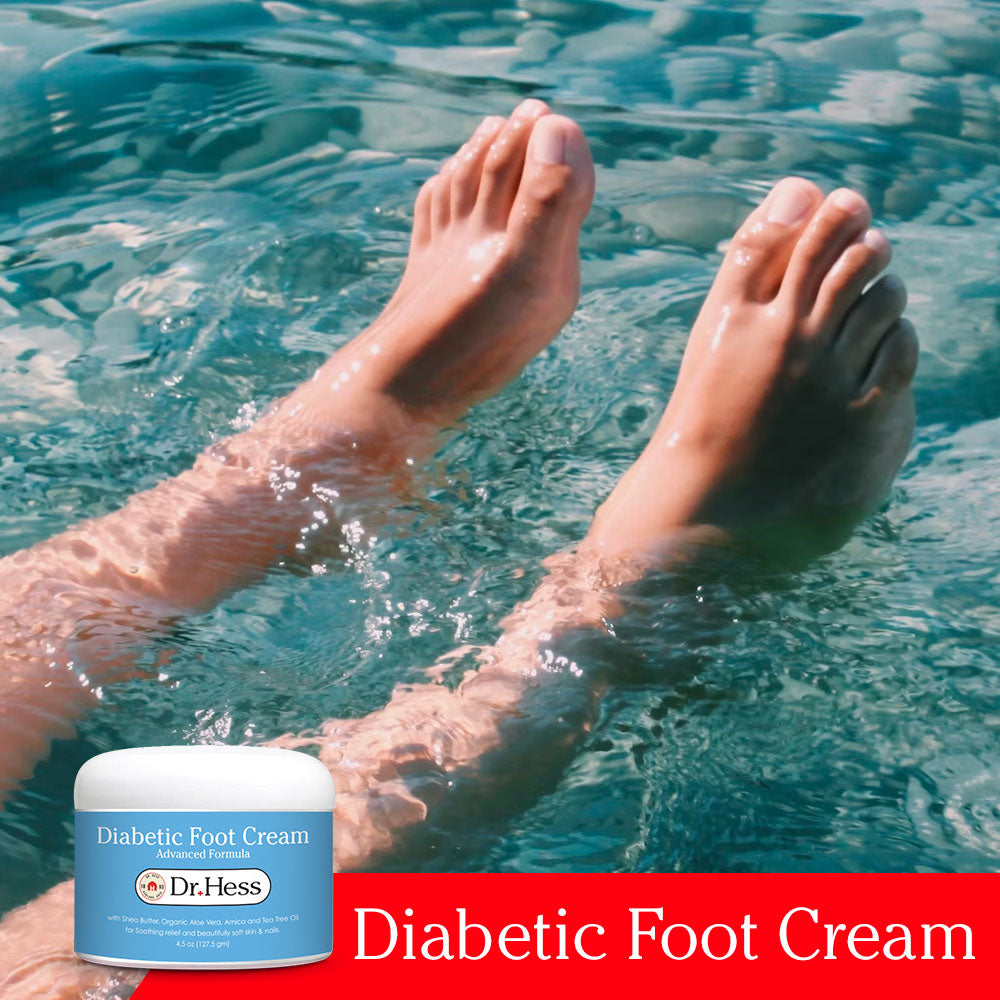 Dr. Hess Diabetic Foot Cream - Advanced Formula, 4.5 Oz