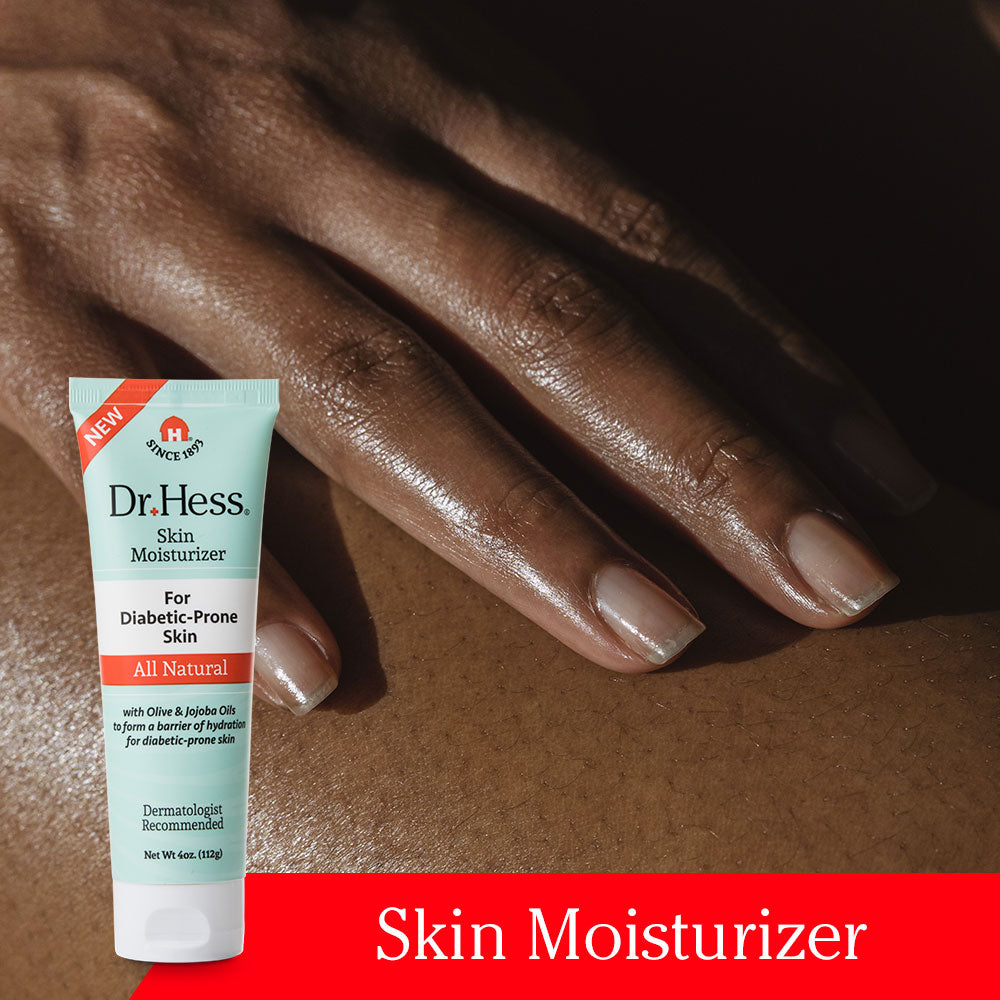 Dr. Hess Skin Moisturizer For Diabetic Prone Skin, 4 Oz