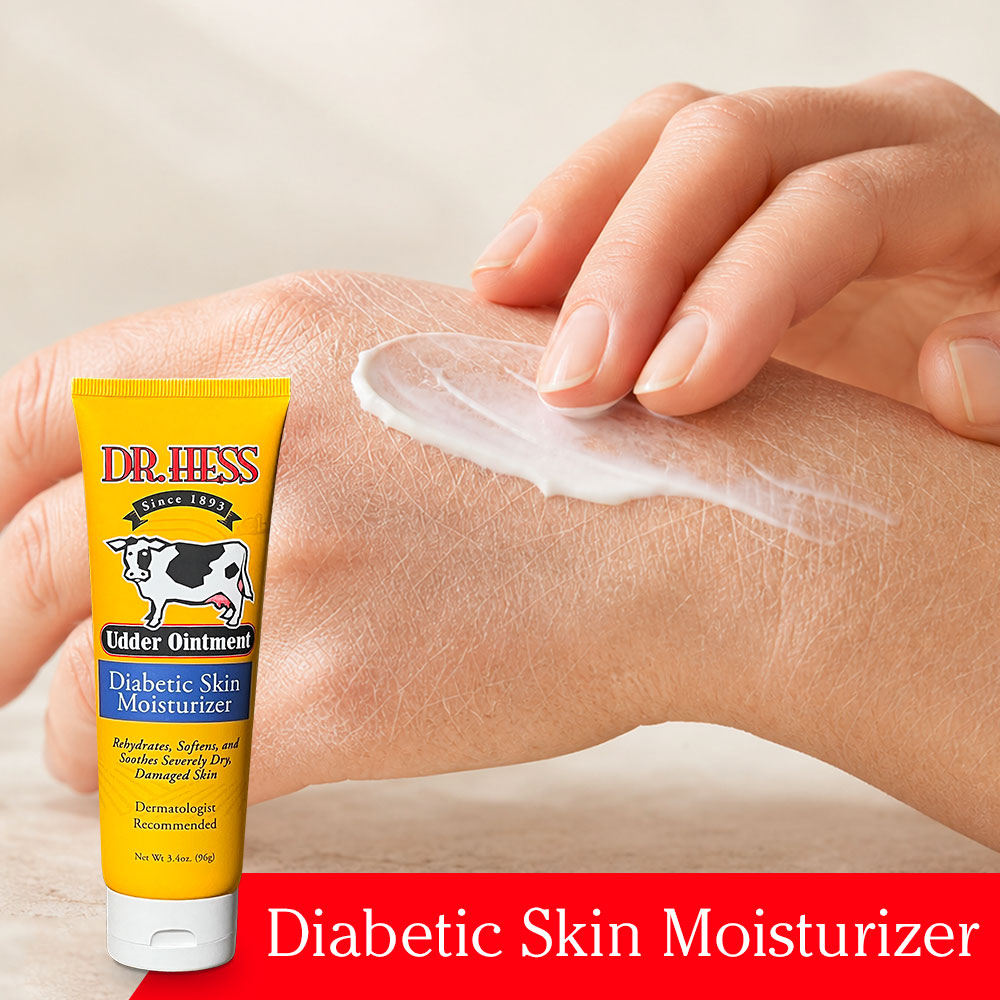 Dr. Hess Udder Ointment Diabetic Skin Moisturizer, 3.4 Oz