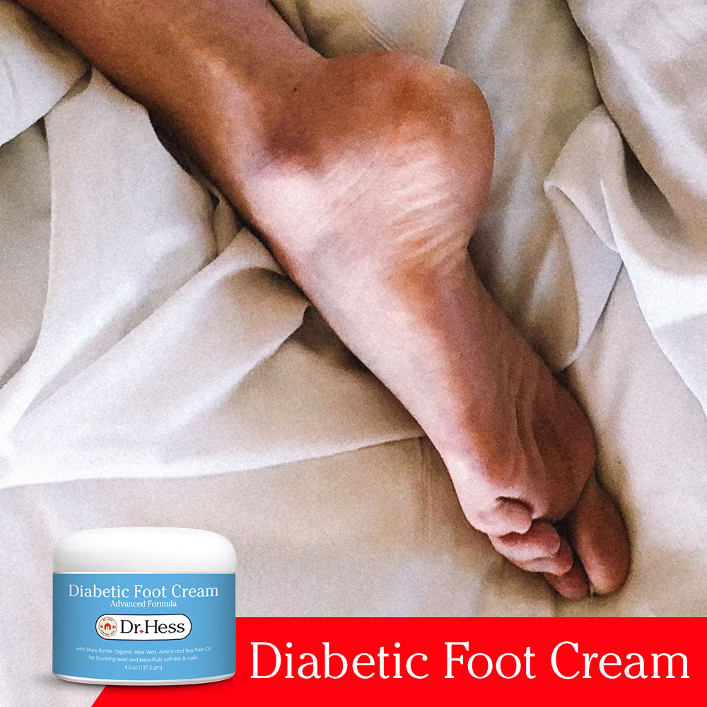 Dr. Hess Diabetic Foot Cream Advanced Formula, 4.5 Oz Dr Hess