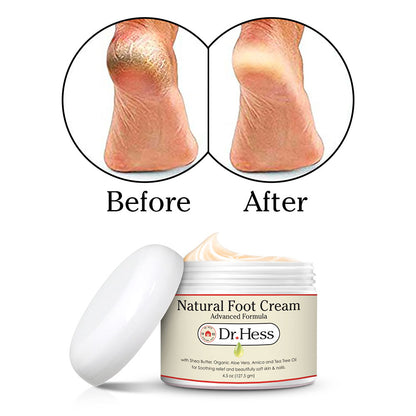 Dr. Hess Natural Foot Cream - Advanced Formula, 4.5 Oz